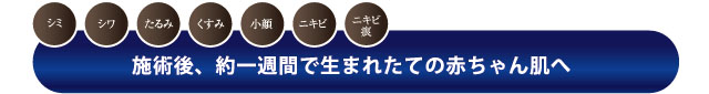 シミ・シワ・たるみ・くすみ・小顔・ニキビ・ニキビ痕 施術後、約一週間で生まれたての赤ちゃん肌へ