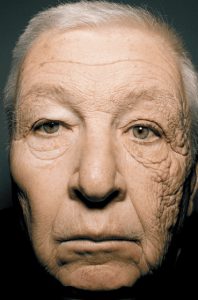 sun-damage-face-120604