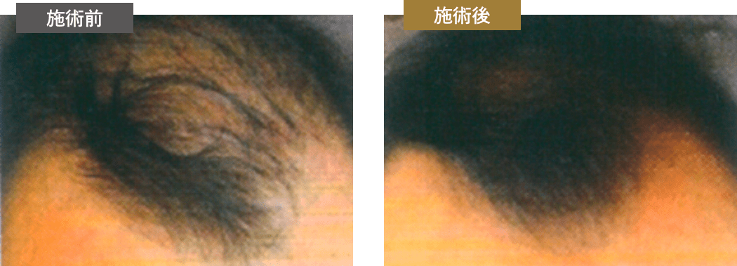 施術前・施術後