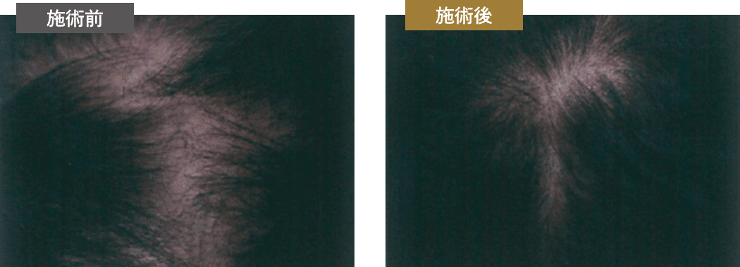 施術前・施術後
